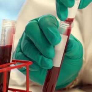 Dekodiranje glavne pokazatelje kemije krvi osobe