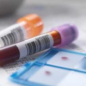 Dešifriranja biokemijske analize parametara u krvi kod djece