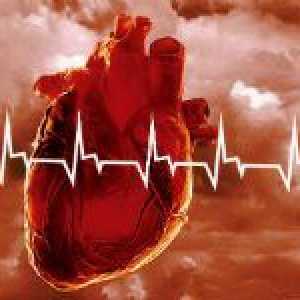 Reanimacija od srčanog zastoja - što trebate znati i moći