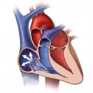Srce regurgitacije ventil: simptomi, mjeri, dijagnoza, liječenje