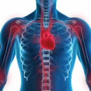 Reumatska groznica i reumatska bolest srca: simptomi, srčane manifestacije, dijagnoze, liječenje,…