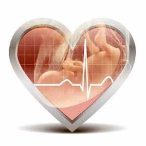 Otkucaji srca fetusa kada je i kako je moguće čuti i kršenja pravilo