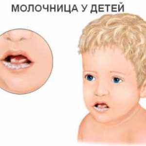 Simptomi i liječenje drozd u djece
