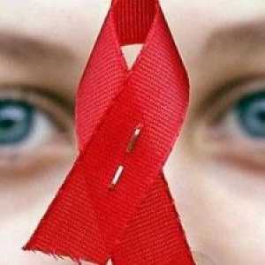Simptomi HIV