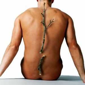 Simtomy i znakovi osteoporoze