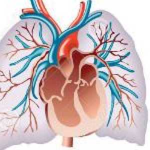 Sindroma plućne hipertenzije