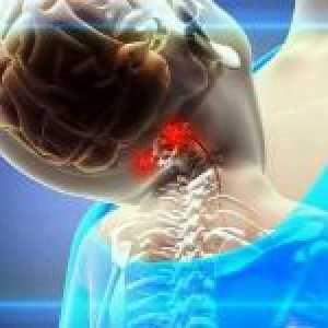 Sindrom vertebralne arterija