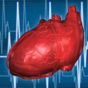 Sindrom ranog polarizacije od srčanih klijetki