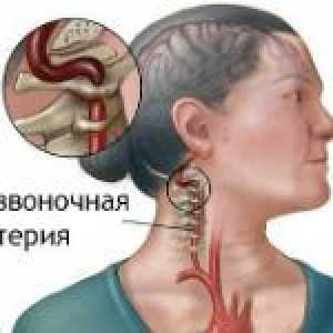 Sindrom vertebrobazilarni-basilaris insuficijencija