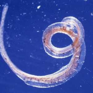 Sipptomy i humani whipworm liječenje