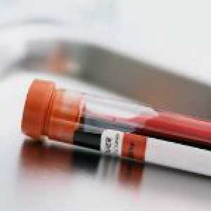 Koliko krvne grupe postoje u ljudima