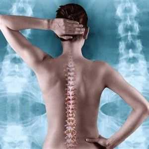 Spinal moždani udar: uzroci, simptomi, liječenje, rehabilitacija, prognoza