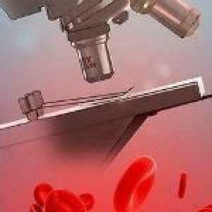 Prosječna sadržaj hemoglobina u eritrocitima (MCHC)