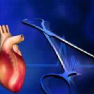 Kako liječiti bolest srca