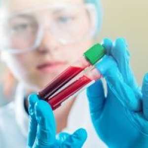 Trombociti u krvi spušta - trombocitopenija: uzroci i liječenje