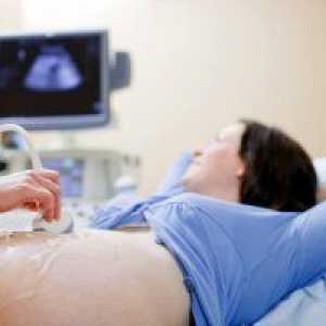 Uzroci staph u dojenčadi, simptomi i rizik od bakterijske infekcije