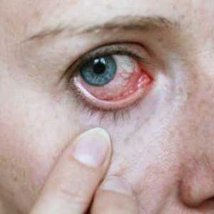 Vitamin kapi za umor očiju i crvenilo