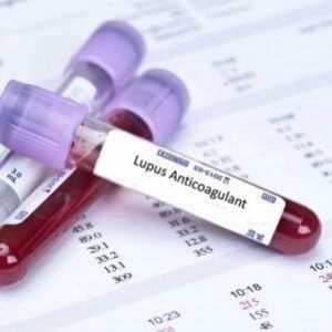 Lupus antikoagulans: jedan je pronađen, što je opasno, a stopa odbijanja, liječenje