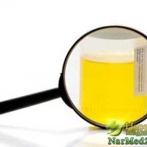 Pojava bjelančevina u urinu i njegove eliminacije metode tradicionalne medicine