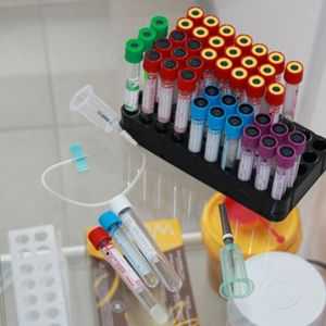 Sve moderne metode za određivanje osjetljivosti na antibiotike