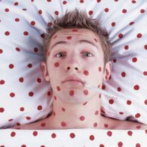 Osip na koži u obliku crvenih točkica: infekcija ili ne?