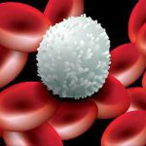 Što bijelih krvnih stanica, a što je uzrokovalo promjenu u njihove razine u krvi?