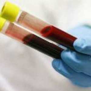 Ključni pokazatelji leukocita u krvi formulom i njegove interpretacije