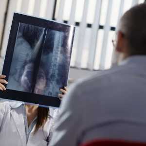 Zašto je rendgenski želuca s barij?