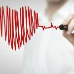Značenje EKG u dijagnostici infarkta miokarda